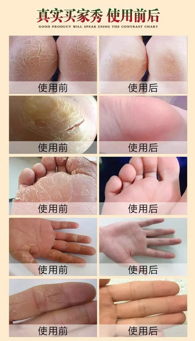 Horse Ointment 80g Oil Anti-Drying Crack Foot Cream Heel Cracked Repair Cream Removal Dead Skin Hand Feet Care for Family