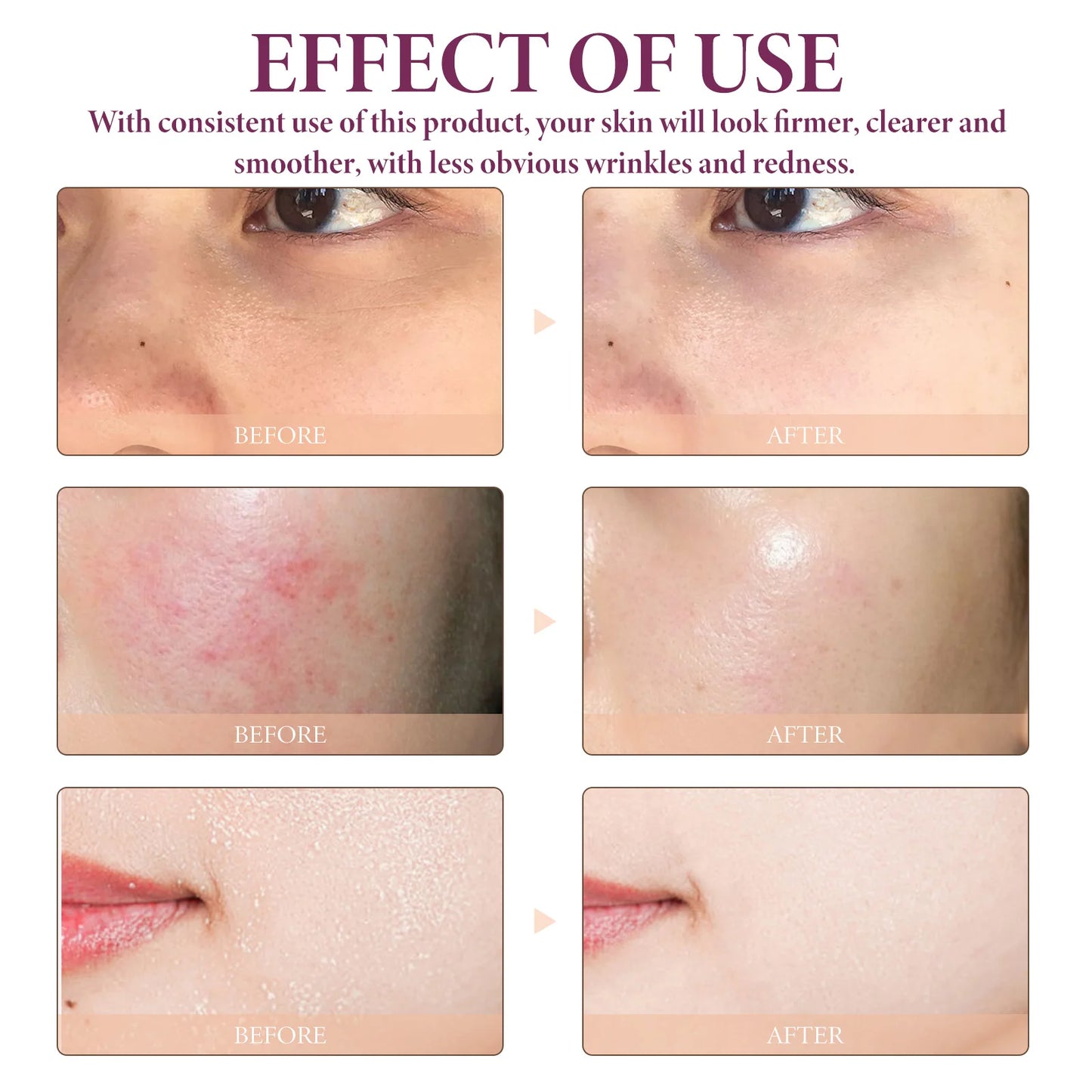 Face Serum Glycolic Acid 10% Toning Solution Fade Fine Lines Firming Improve Facial Dryness Redness Glycolic Acid Repair Essence