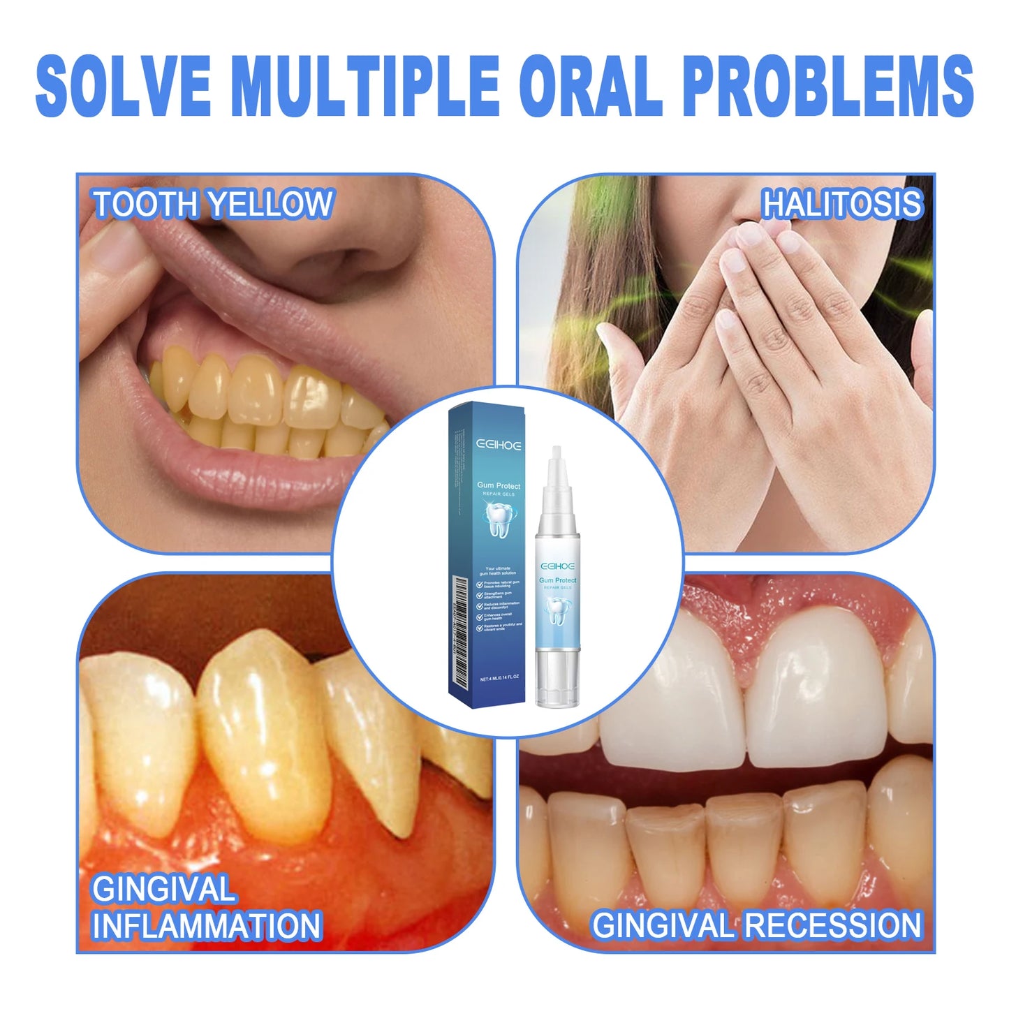 Damaged Gum Repair Care Gel Deep Cleaning Effectively Removes Yellow Teeth Stains Tartar Fresh Breath Teeth Cleaning Gel 4ml