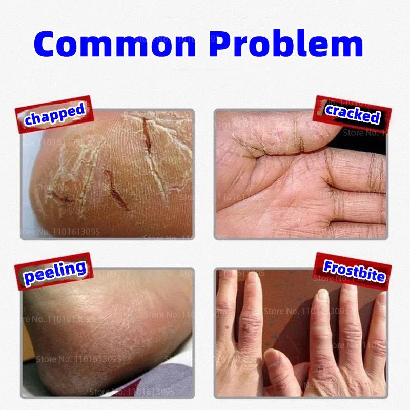 Horse Ointment 80g Oil Anti-Drying Crack Foot Cream Heel Cracked Repair Cream Removal Dead Skin Hand Feet Care for Family